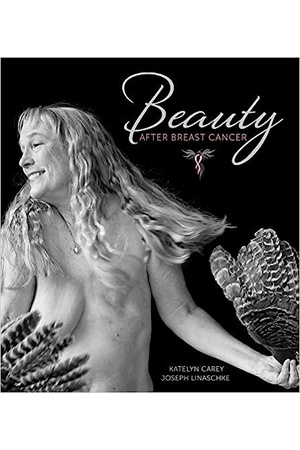 Beauty After Breast Cancer: 38 Patients Share Bare-Chested Portraits and Tips for Recovery